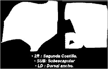 O terapeuta faz contato com a mão caudal no cotovelo e o leva em adução ao mesmo tempo em que a