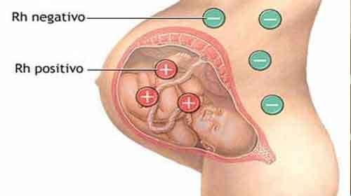 Eritroblastose fetal É uma doença que ocorre quando o sangue de um feto