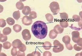 Neutrófilos Neutrófilos: defesa contra infecções bacterianas e outros pequenos processos inflamatórios.