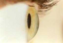 Aqui estão alguns exemplos do que os olhos não saúdaveis podem