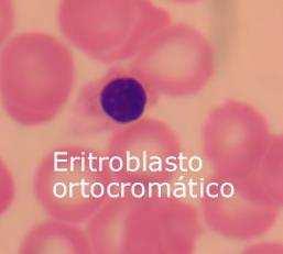 Aula nucléolo, cromatina muito condensada.