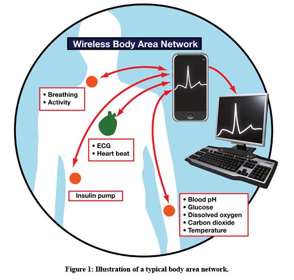 Saúde Biossensores Monitoramento de sinais vitais : temperatura,