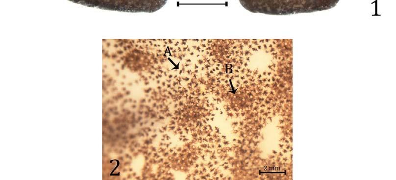 Both structures are present in the skin surface.