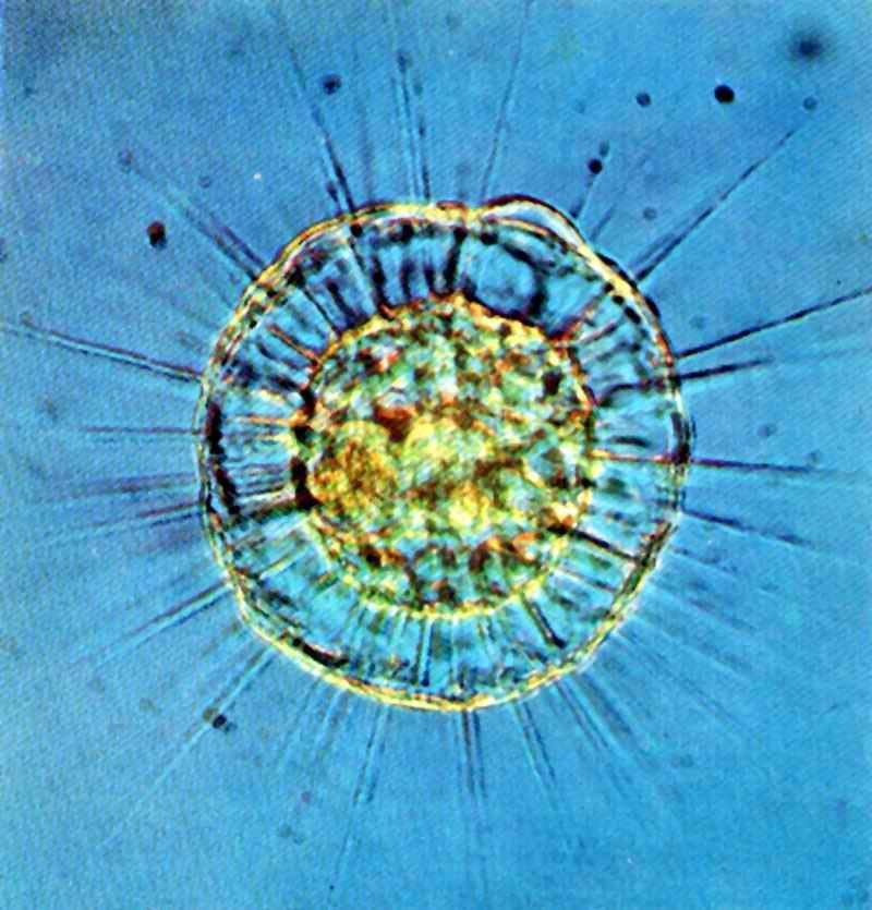 Protozoários ameboides Protistas e Algas