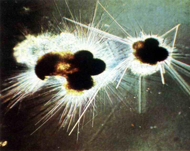 pseudópodes longos e finos Protozoários