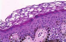 Seção I: O Básico Em Dermatopatologia 1 Características das células em pequeno aumento e vistas de perto Mariya Miteva e Jacquelyn Dosal Epiderme Definição: camada superficial da pele formada por