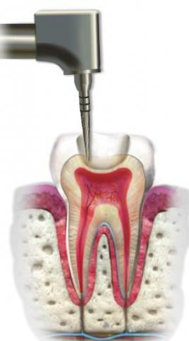 evitar a perda prematura de dentes, quer que seja por