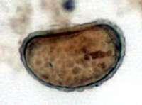 Polypodiaceoisporites sp.