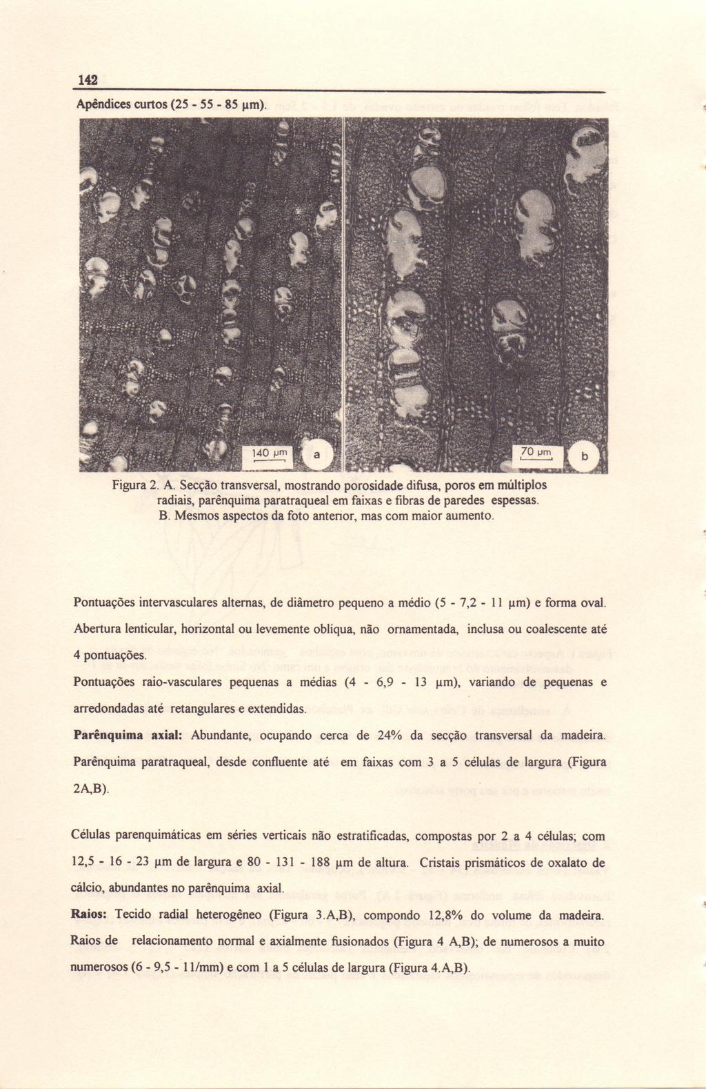 142 Apêndices curtos (25-55 - 85 11m). Figura 2. A. Secção transversal, mostrando porosidade difusa, poros em múltiplos radiais, parênquima paratraqueal em faixas e fibras de paredes espessas. B.