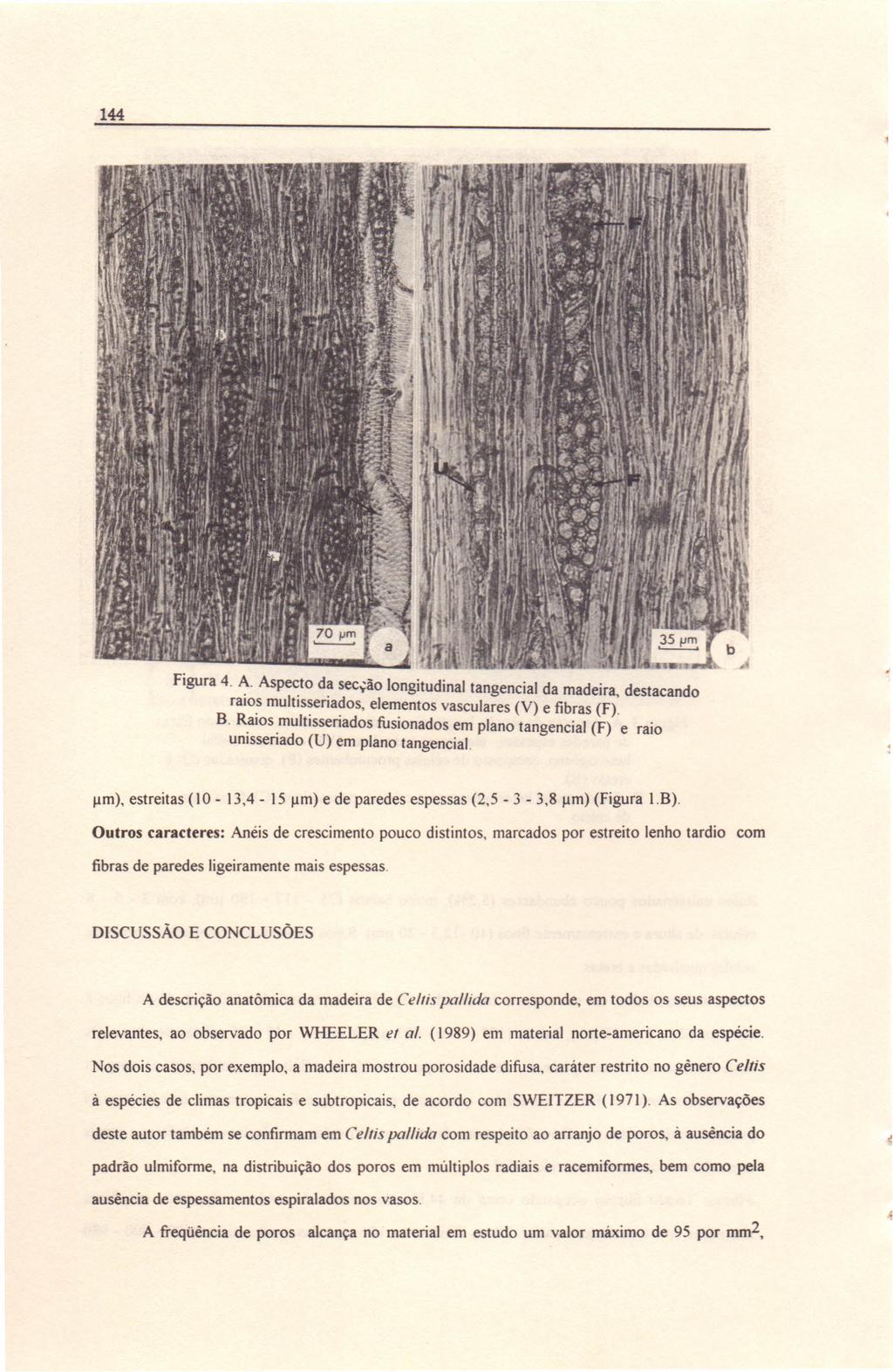 144 Figura 4. A. Aspe~to da secção longitudinal tangencial da madeira, destacando raios multlssena~os, elementos vasculares (V) e fibras (F). B.