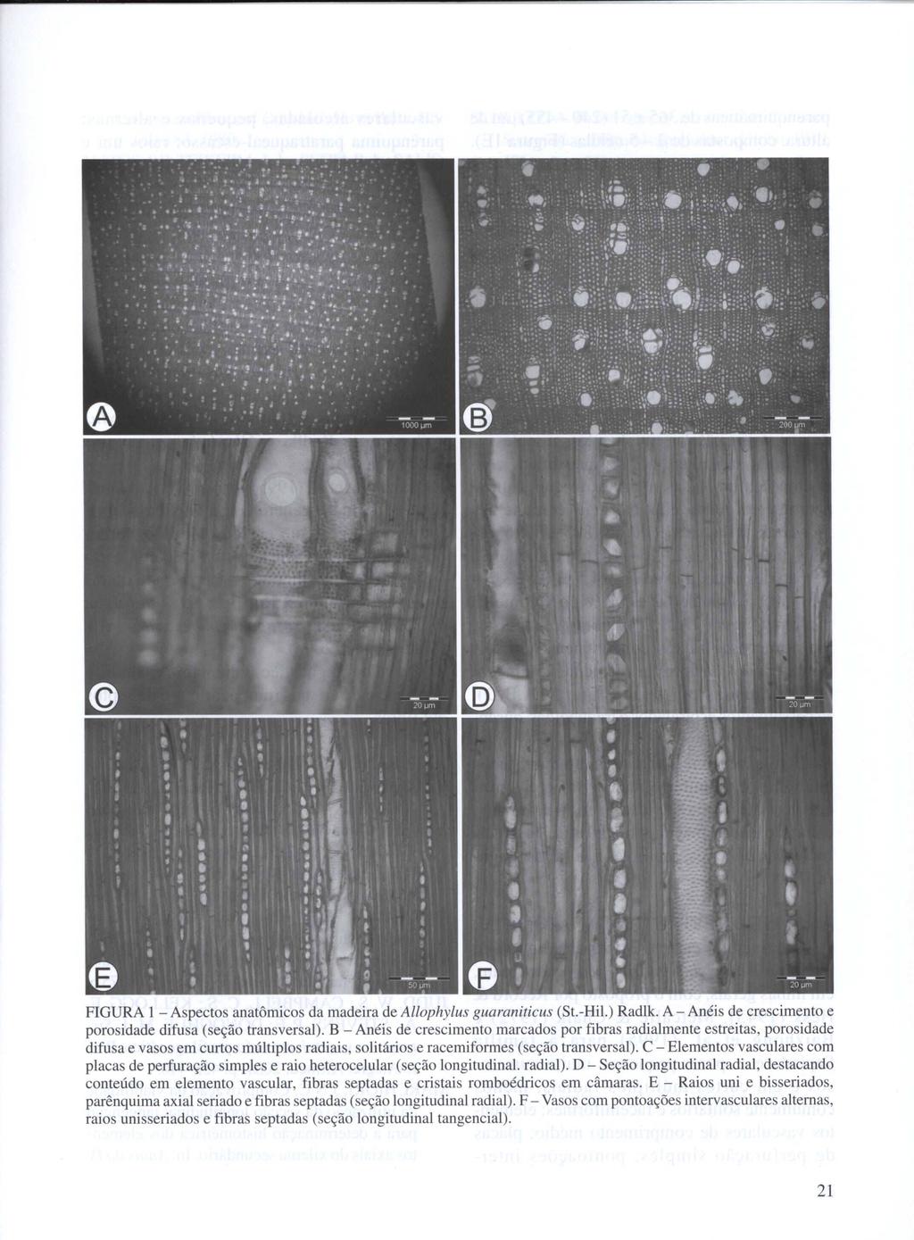 FIGURA 1 - Aspectos anatômicos da madeira de Allophylus guaraniticus (St.-Hil.) Radlk. A - Anéis de crescimento e porosidade difusa (seção transversal).