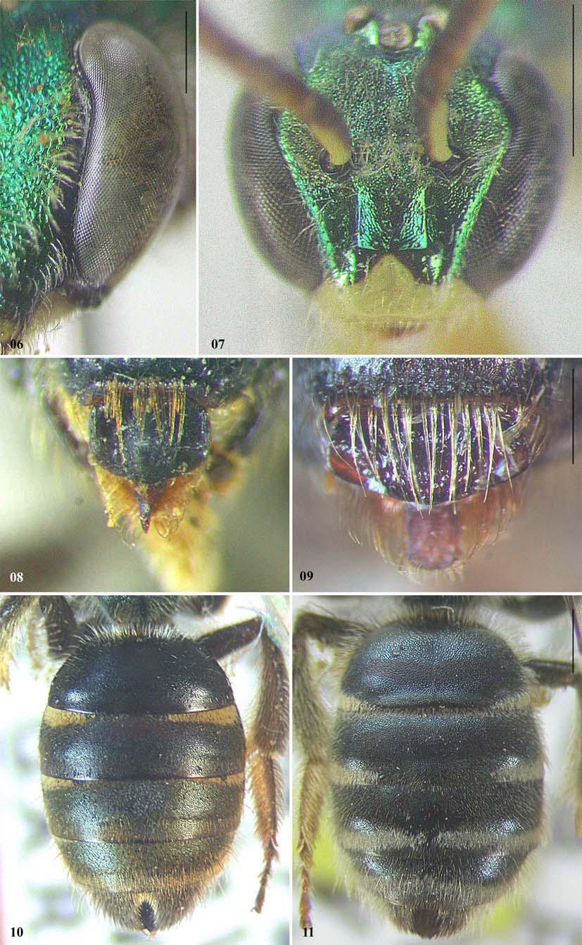 Figuras 06-11. (06) área parocular de A. (Agapostemon) semimelleus, fêmea. (07) Face de Habralictus flavopictus, macho. (08) Labro de P. (Neagapostemon) cyanomelas, fêmea.