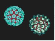 Condiloma acuminado, verruga genital ou crista de galo É causado pelo papilomavírus humano HPV que forma verrugas nos órgãos genitais, no colo do útero e ao redor do ânus.