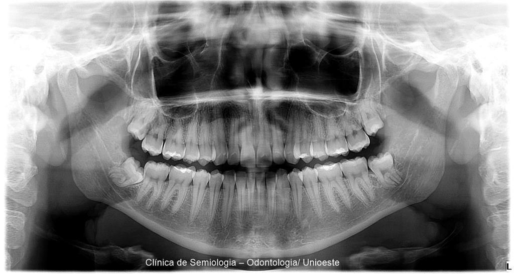 Muitas patologias estudadas têm íntima relação com estresse,