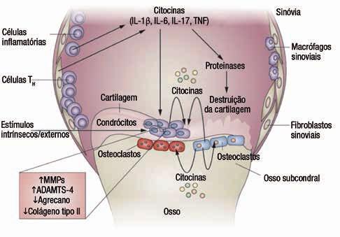 OSTEOARTRITE O QUE É Figura 1 - Papel das citocinas pró-inflamatórias na fisiopatologia da osteoartrite.