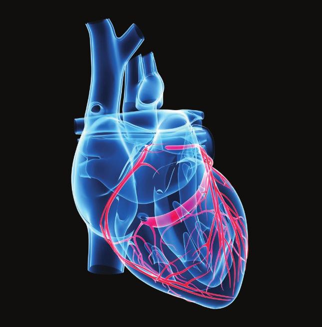 Pode ser realizado cateterismo cardíaco ou fibrinolítico, de acordo com a disponibilidade do serviço e as condições do paciente. CPK: É sensível, porém pouco específica.