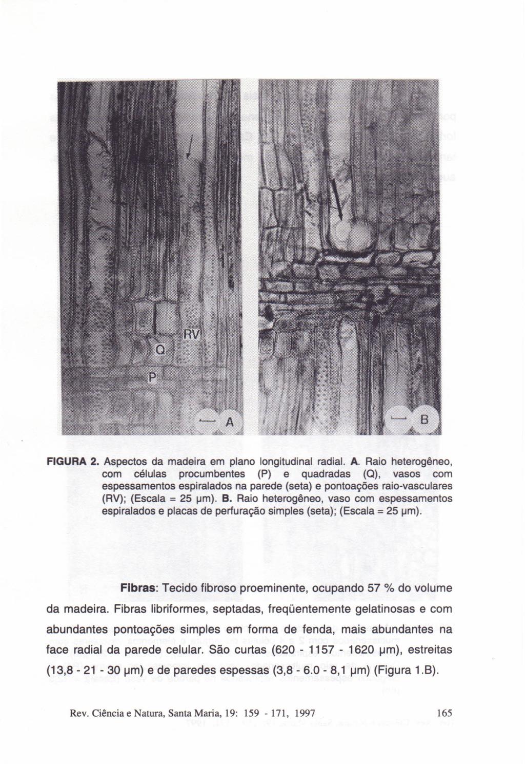 FIGURA 2. Aspectos da madeira em plano longitudinal radial. A. Raio heterogêneo, com células procumbentes (P) e quadradas (Q), vasos com espessamentos espiralados na parede (seta) e pontoações raio-vasculares (RV); (Escala = 25 um).