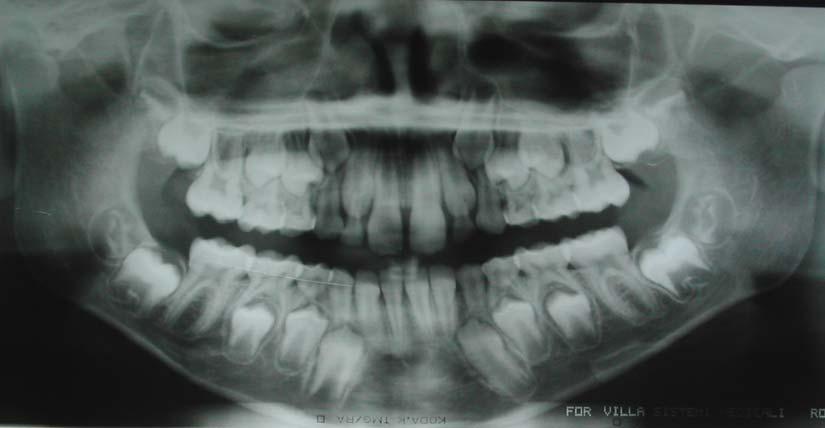 D E FIGURA 8 - Radiografia panorâmica: dentição