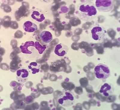 Hemoparasitoses em cães e gatos 3 A B C Figura 1. Imagens microscópicas de hemoparasitas de lâminas coradas pelo método panótico.