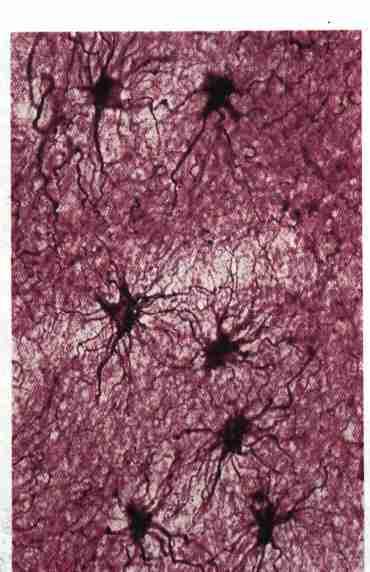 ASTRÓCITOS PROTOPLASMÁTICOS Localizados na substância