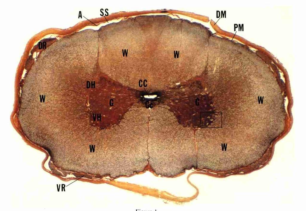 MEDULA NERVOSA