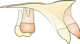 molares superiores, pois as alterações verticais destes dentes foram muito semelhantes ao do grupo controle.