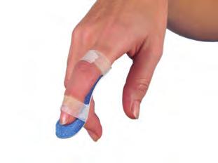 São altamente eficazes já que permitem ao doente manter a função da mão. Fácil de colocar. Pode ser utilizada mais de uma férula num dedo graças à sua pequena espessura.