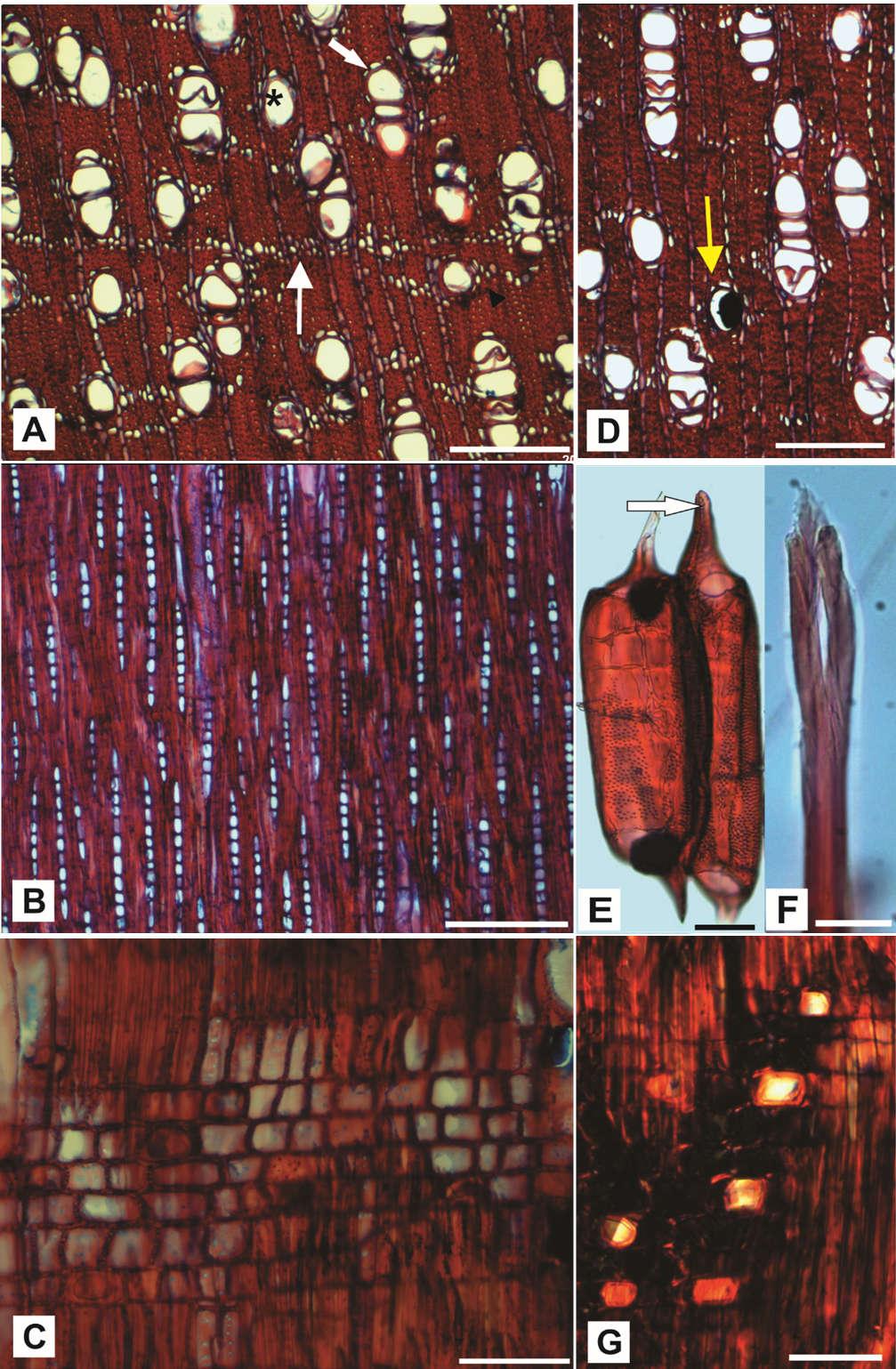 Figura 5. Anatomia do lenho de Trichilia casaretti. A. Vasos solitários (asterisco), vasos múltiplos (seta cheia), parênquima axial em faixas (seta fina) e parênquima axial paratraqueal aliforme (cabeça de seta), ST.