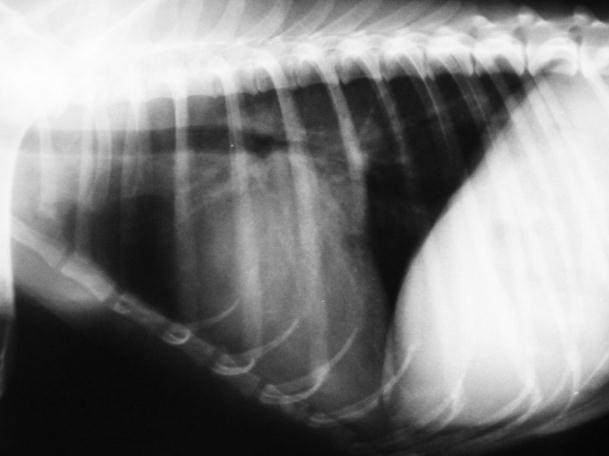 inflamação pulmonar e