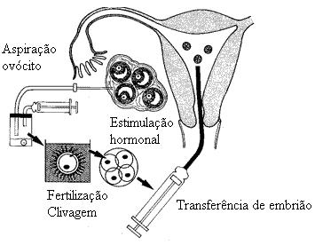 reduzem a formação dos radicais oxidantes e melhoram a habilidade de fertilização dos espermatozóides (FRANCO JUNIOR et al., 2004). As taxas de gravidez por ciclo variam entre 8% a 22%.