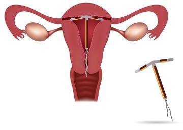 ÓRGÃOS REPRODUTIVOS FEMININOS E FUNÇÕES Tubas uterinas: