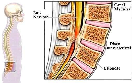 musculos serão relaxados e alongados distanciando as