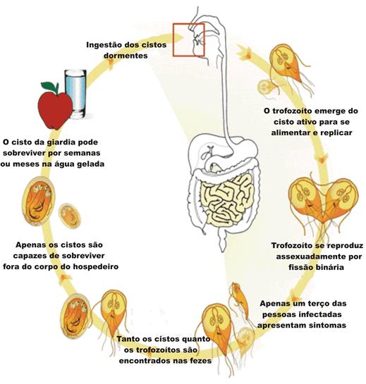 Parasitoses intestinais: Giardíase: infecção do Intestino delgado causada por protozoário = Giárdia lamblia = formas de cisto e trofozoíto = cisto é a