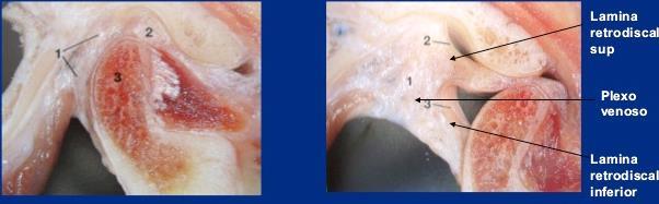 Coxim retrodiscal Limitado acima e abaixo pela zona bilaminar Zona bilaminar: parte superior fibras elásticas (fixa ao temporal) parte inferior fibras colágenas (fixa à mandíbula) Sistema