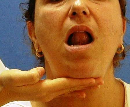 G A B C H F E D I 16 Abertura da boca ou depressão da mandíbula Movimento Articular: Rotação + Translação anterior
