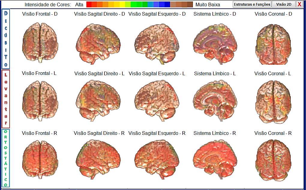 Interpretação do Cérebro Emocional e o Cérebro Racional, As imagens do cérebro mostram uma pessoa com pouca habilidade para lidar com suas emoções.