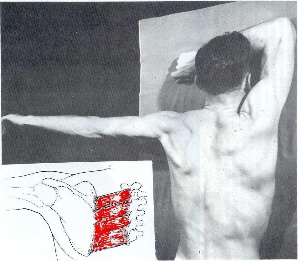 / Ext Cotovelo: Ext 0 Fixação: na escápula oposta Pressão: 1/3 distal do antebraço no sentido de adução horizontal 12