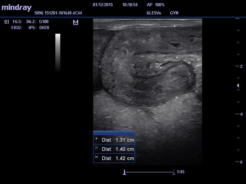 Materiais e Métodos 39 ovários (mm) e diâmetro uterino (mm).
