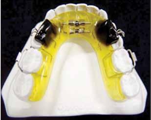 A mandíbula, parte integrante desse conjunto participa de modo ativo na manutenção desse equilíbrio fisiológico, para que a função e a estética estejam em equilíbrio.