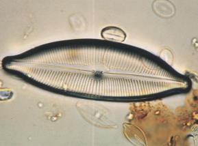 3 Diatomáceas Bacilariófitas; Unicelulares;