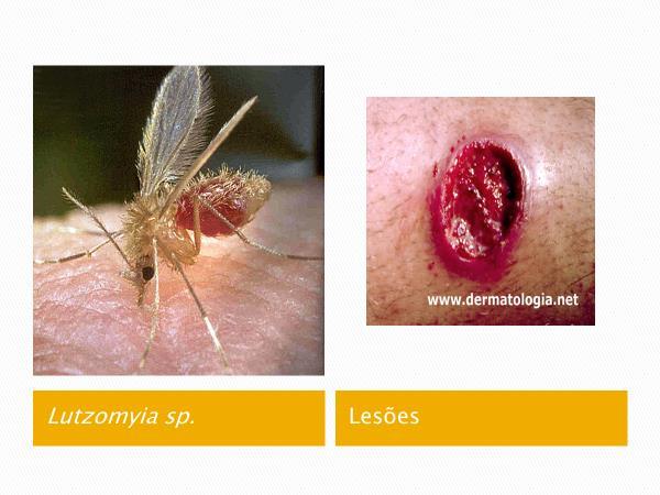 contaminadas; mãe para o feto; Hospedeiros definitivo: felinos gatos; Hospedeiro intermediário: ser humano, carneiros, porco e aves; Sintomas: alterações neurológicas.