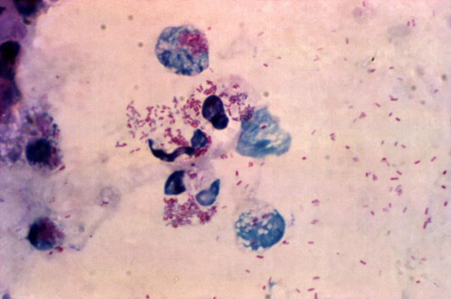 Bactérias de Importância Epidemiológica Legionella