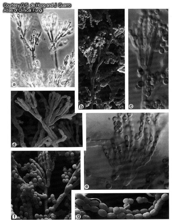 Microfotografia de fungos do gênero Penicillium: Conidióforos e