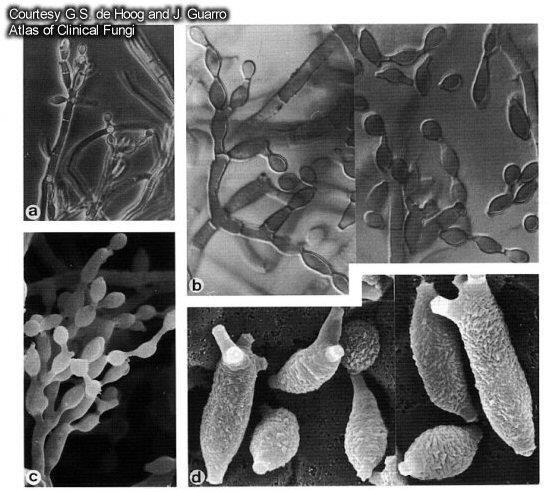 Microfotografia de fungos do gênero Cladosporium: