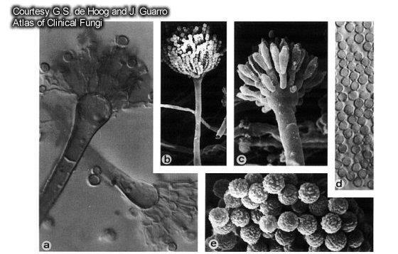 Microfotografia de fungos do