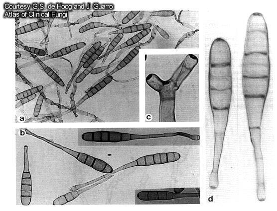 Microfotografia de fungos do gênero Alternaria:
