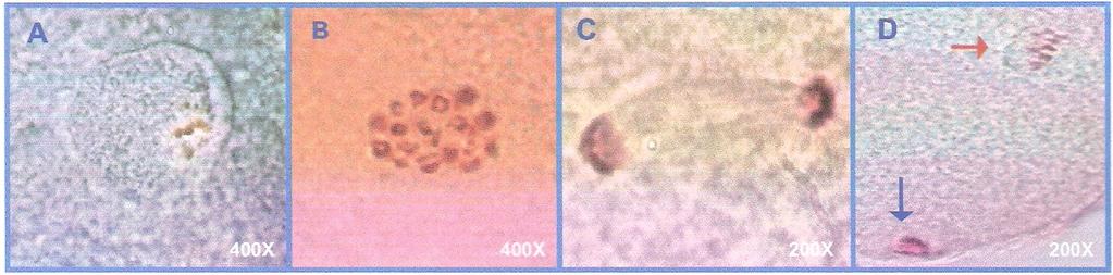 24 Para determinação do estádio da meiose, depois de corados os ovócitos foram observados em microscópio de contraste de fase (Olympus ) em aumento de 1000x.