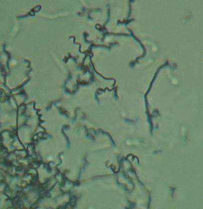 Micélio vegetativo estrutura filamentosa Micélio