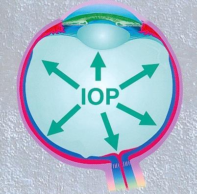 Figura 1. Acredita-se que o principal fator de risco para o glaucoma seja a pressão intra-ocular elevada. Quais são os fatores de risco para se desenvolver o glaucoma?