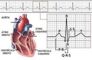 3) Qual a diferença entre o ECG Normal e o de Fibrilação Arterial?